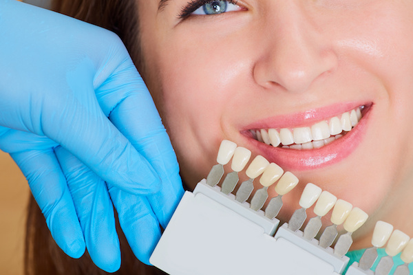 Tips for Maintaining your White Smile After Tooth Whitening Treatments