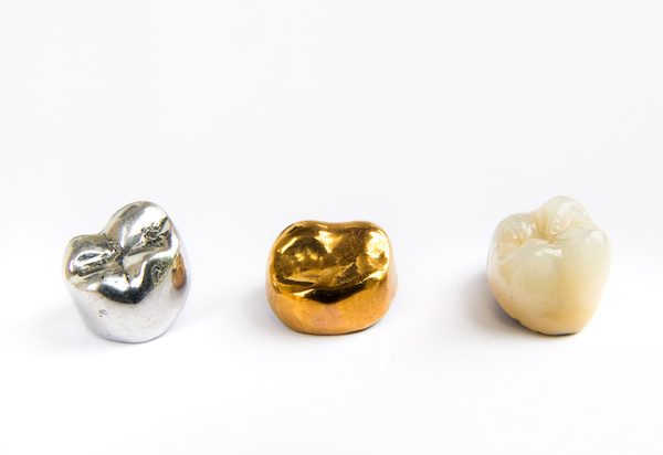 When You Should Consider Crowns