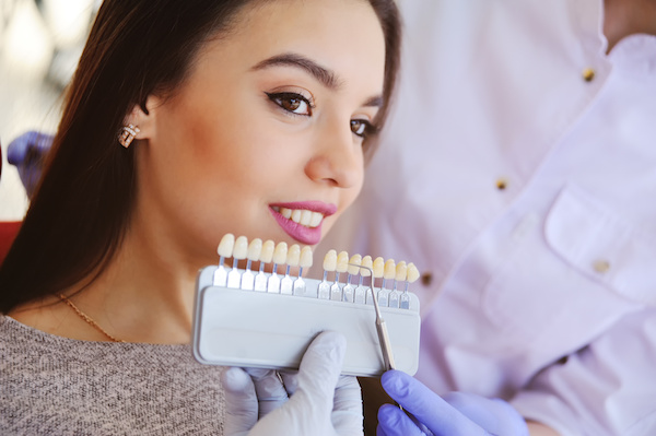 4 Things to Know When Considering Veneers