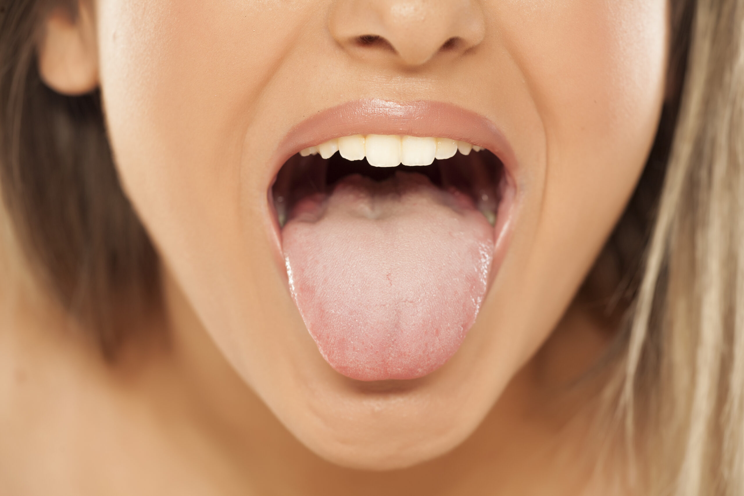 Don’t Overlook the Health of Your Tongue