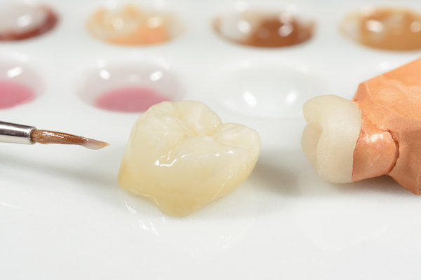 All About Crowns