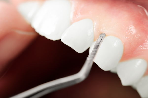 Oral Health -Why are My Gums Bleeding?