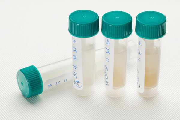 Could dental offices become cancer screening grounds?