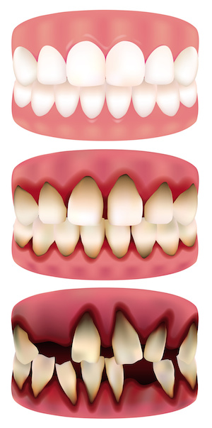 Bleeding gums? Call us.