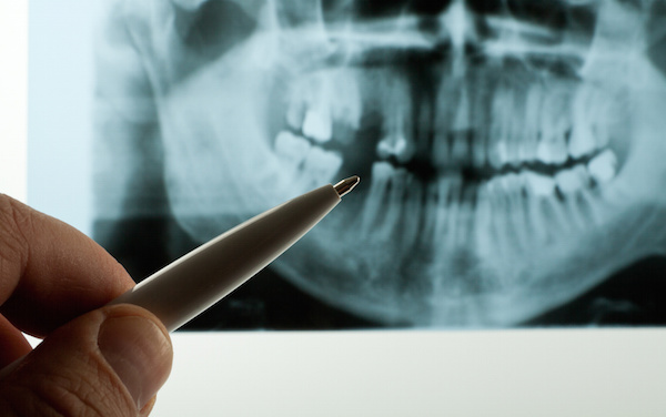 Biomatrix Designs for Periodontal Tissues