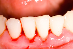 Problems with your gums?