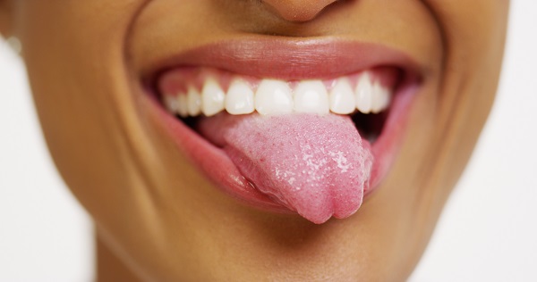 Take Care of Your Tongue