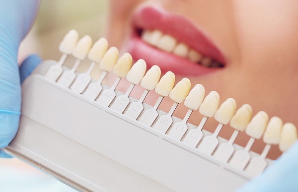 Choosing Veneers