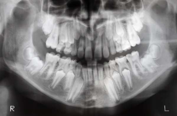 digital images help dentists diagnose dental issues