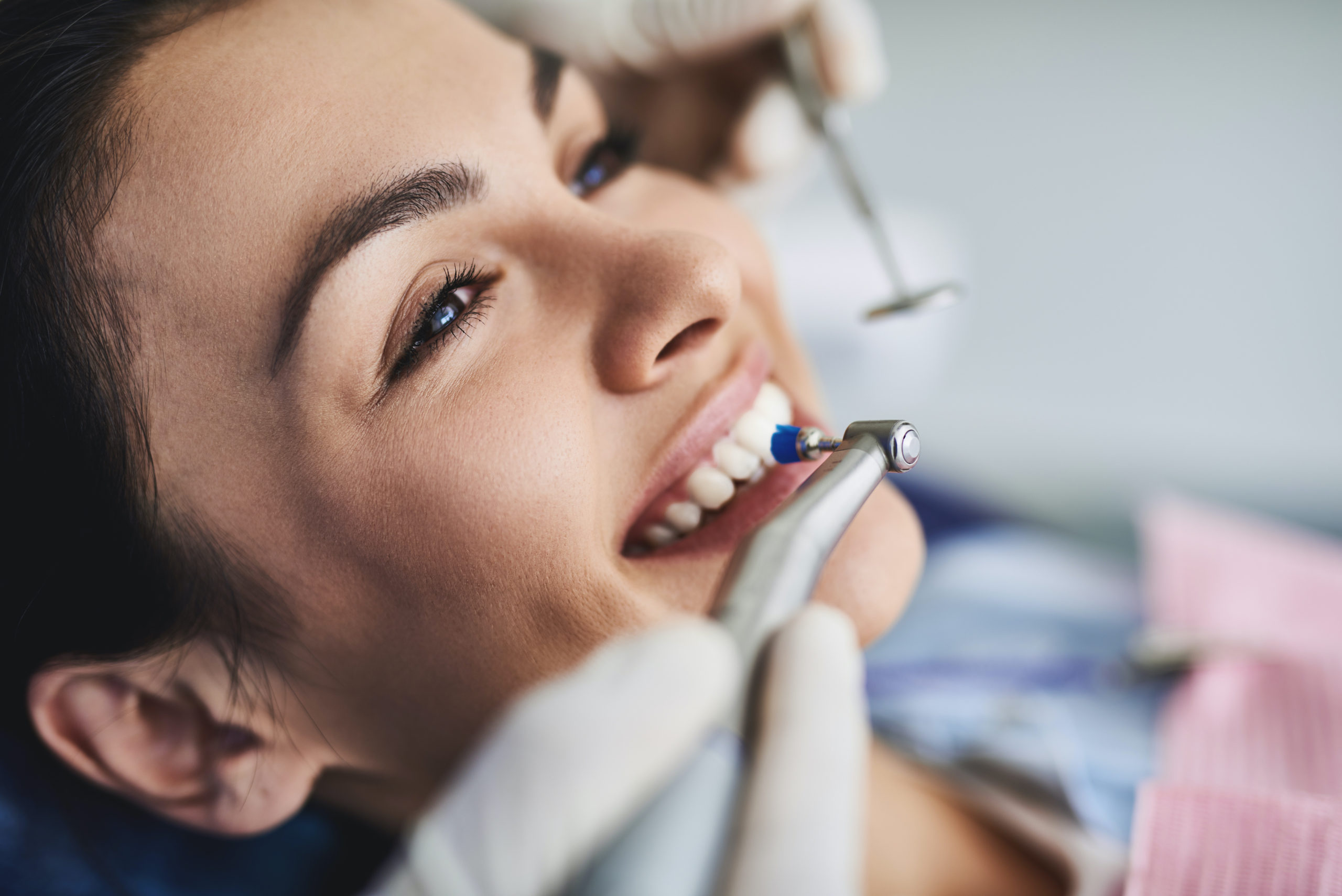 Annual Holistic Dental Cleanings Improve Your Health & Smile