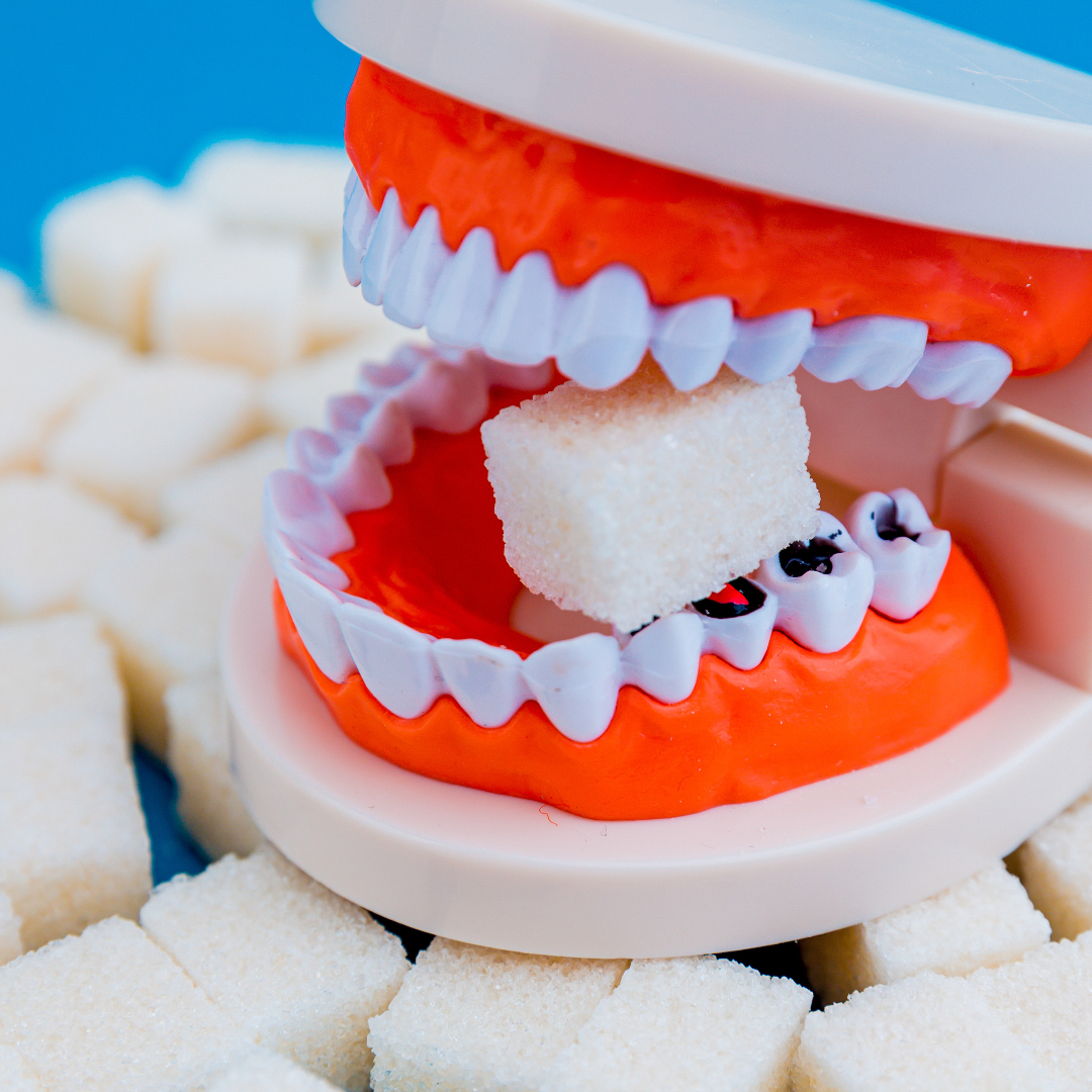 How Sugar Affects Your Oral Health and Smile