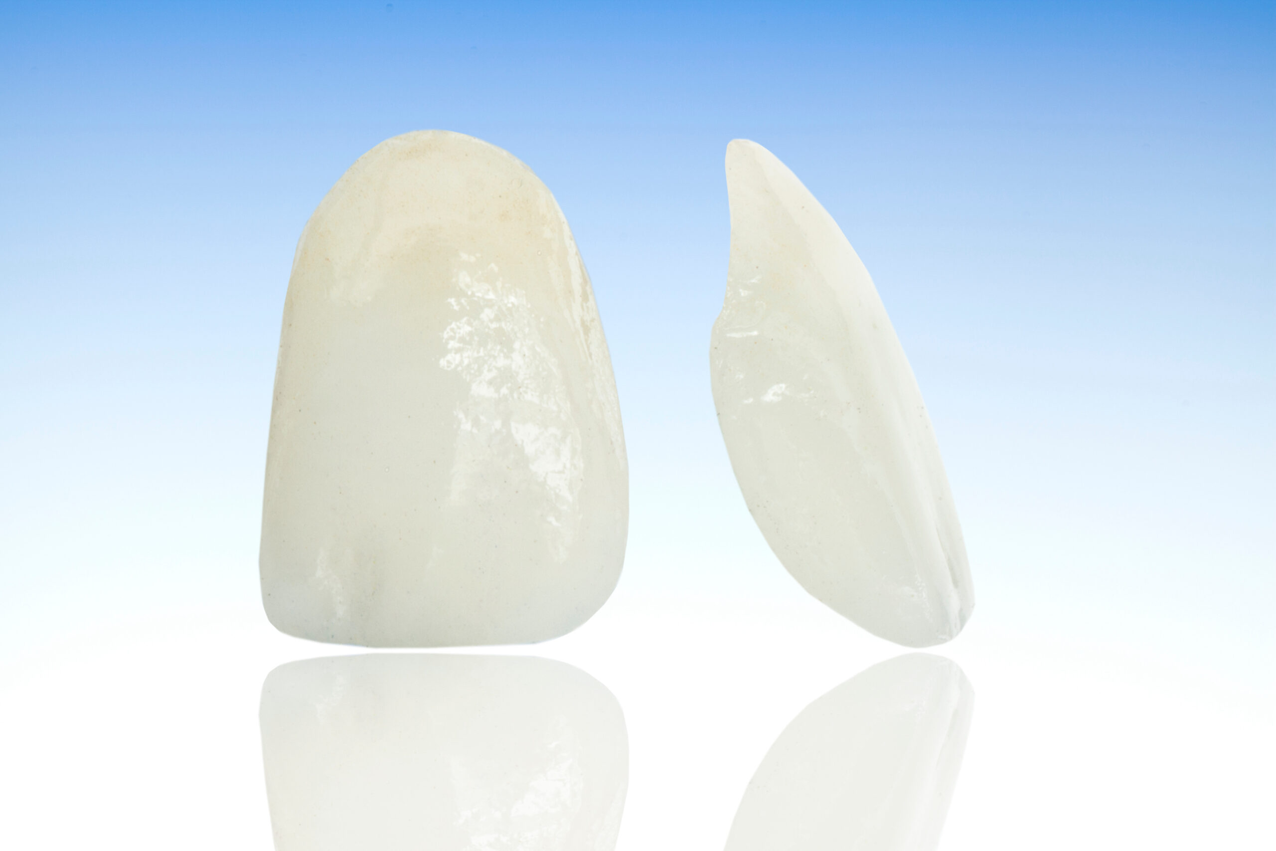Can You Get Veneers with Crooked Teeth?
