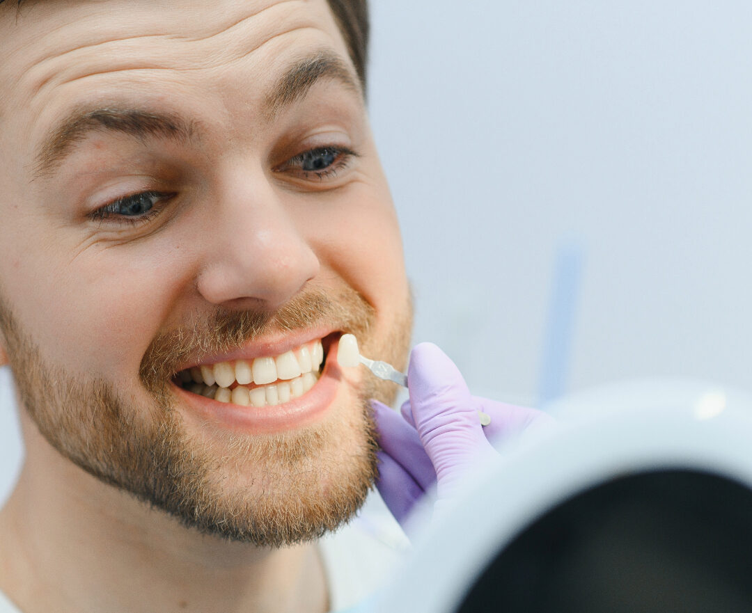 Veneers vs. Crowns: Which is Right for You?