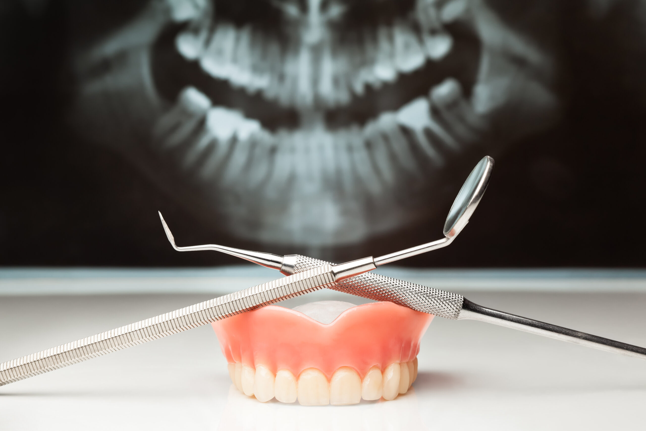 Implant-Supported Dentures: Enhanced Stability and Functionality